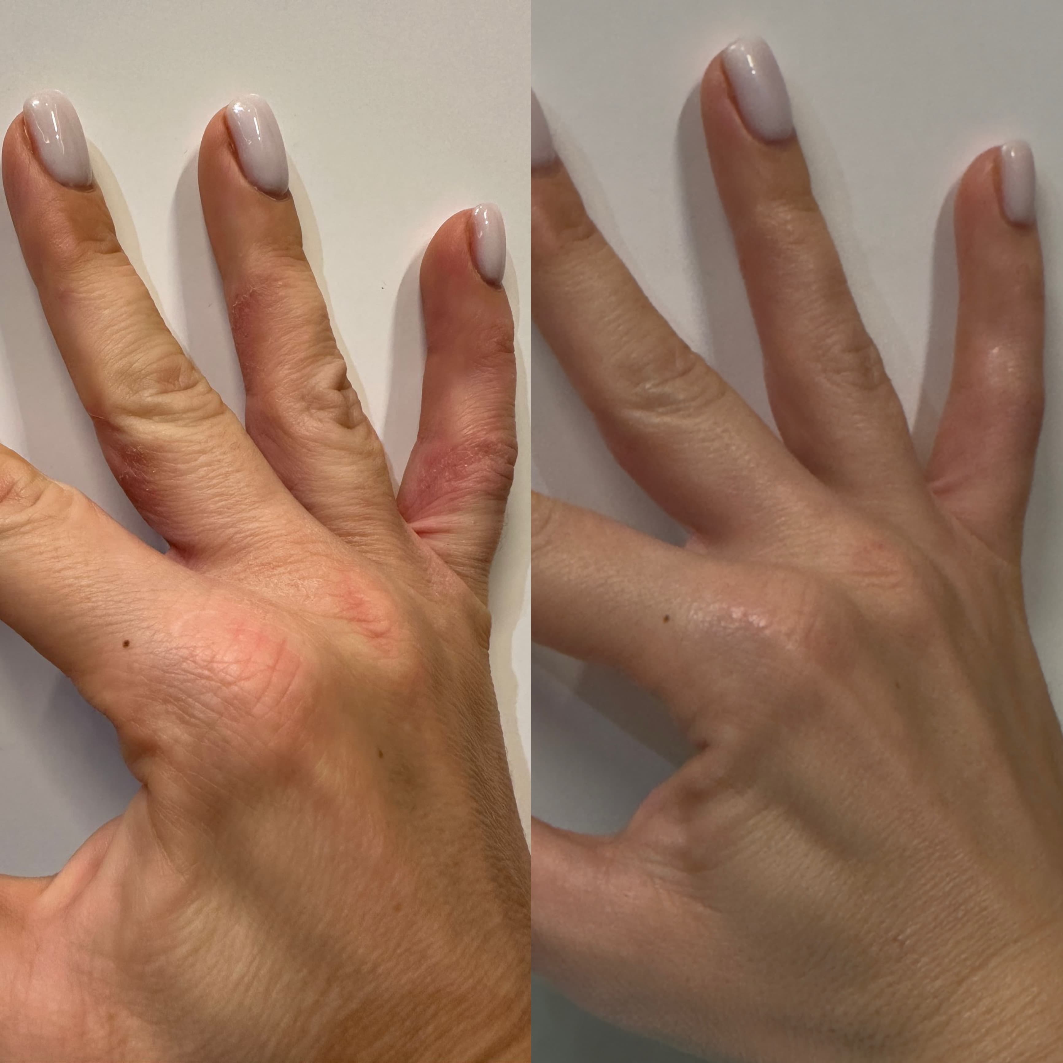 Buy CBD Cream for sensitive skin